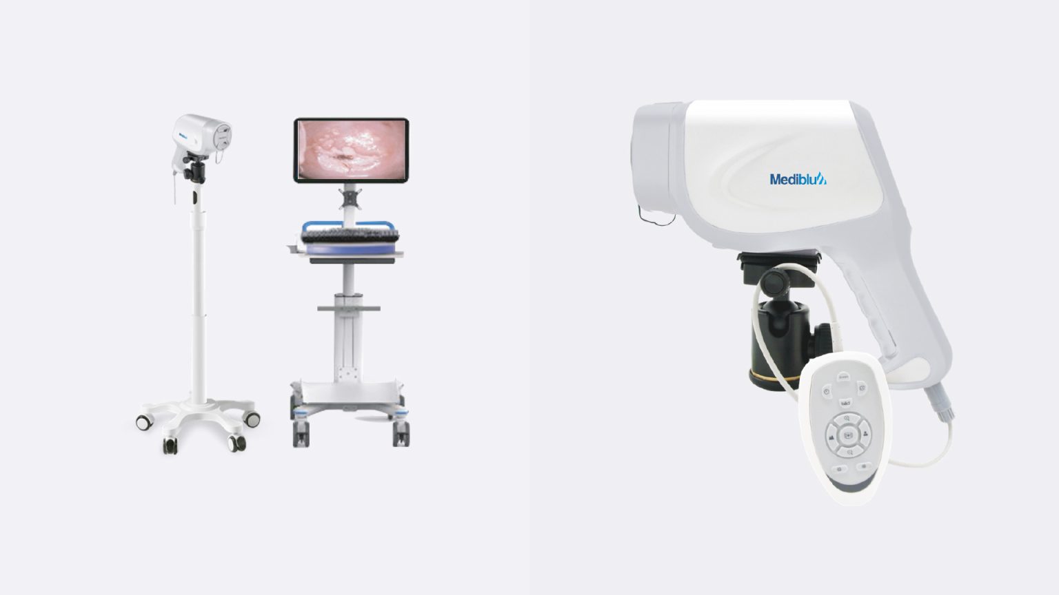 Colposcopio dvc300 Diagnóstico Médico SAC Perú